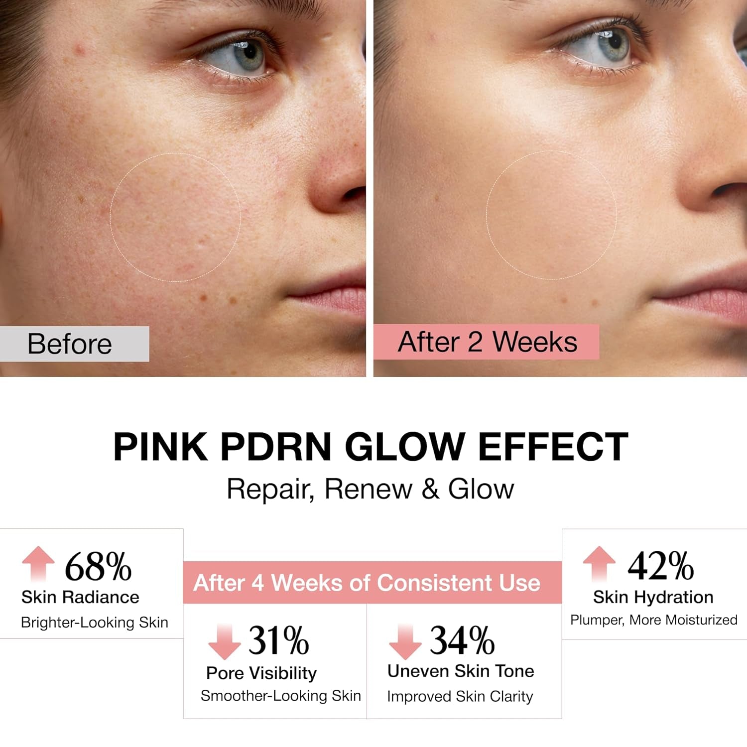 PDRN Pink Peptide Salmon DNA Serum Pink Glow, 5% Niacinamide-1Fl Oz | PDRN Serum with Niacinamide & Peptides for Rejuvenation, Hydration, Skin Barrier Support, Smoothing, Uneven Tone, Korean Care